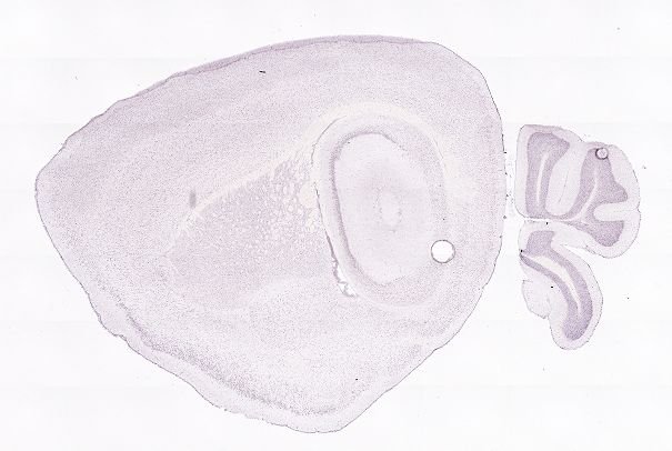 Allen ISH experiment 75985880, image 75863035 -- target region: MH (Medial habenula)