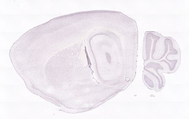 Allen ISH experiment 75985880, image 75863037 -- target region: MH (Medial habenula)