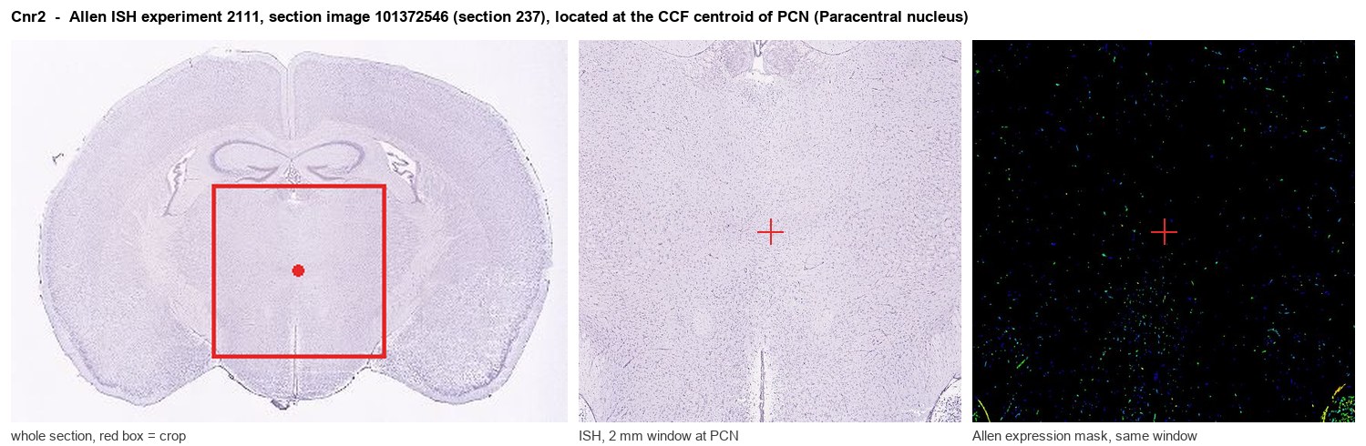 Cnr2 Allen ISH at the CCF centroid of PCN