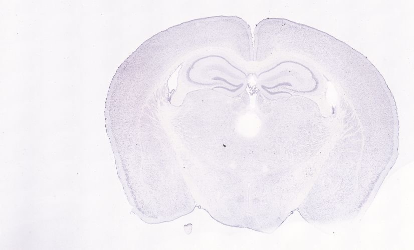 Allen ISH experiment 75651227, image 75587542 -- target region: ME (Median eminence)