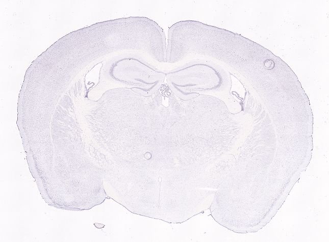 Allen ISH experiment 75651227, image 75587544 -- target region: ME (Median eminence)