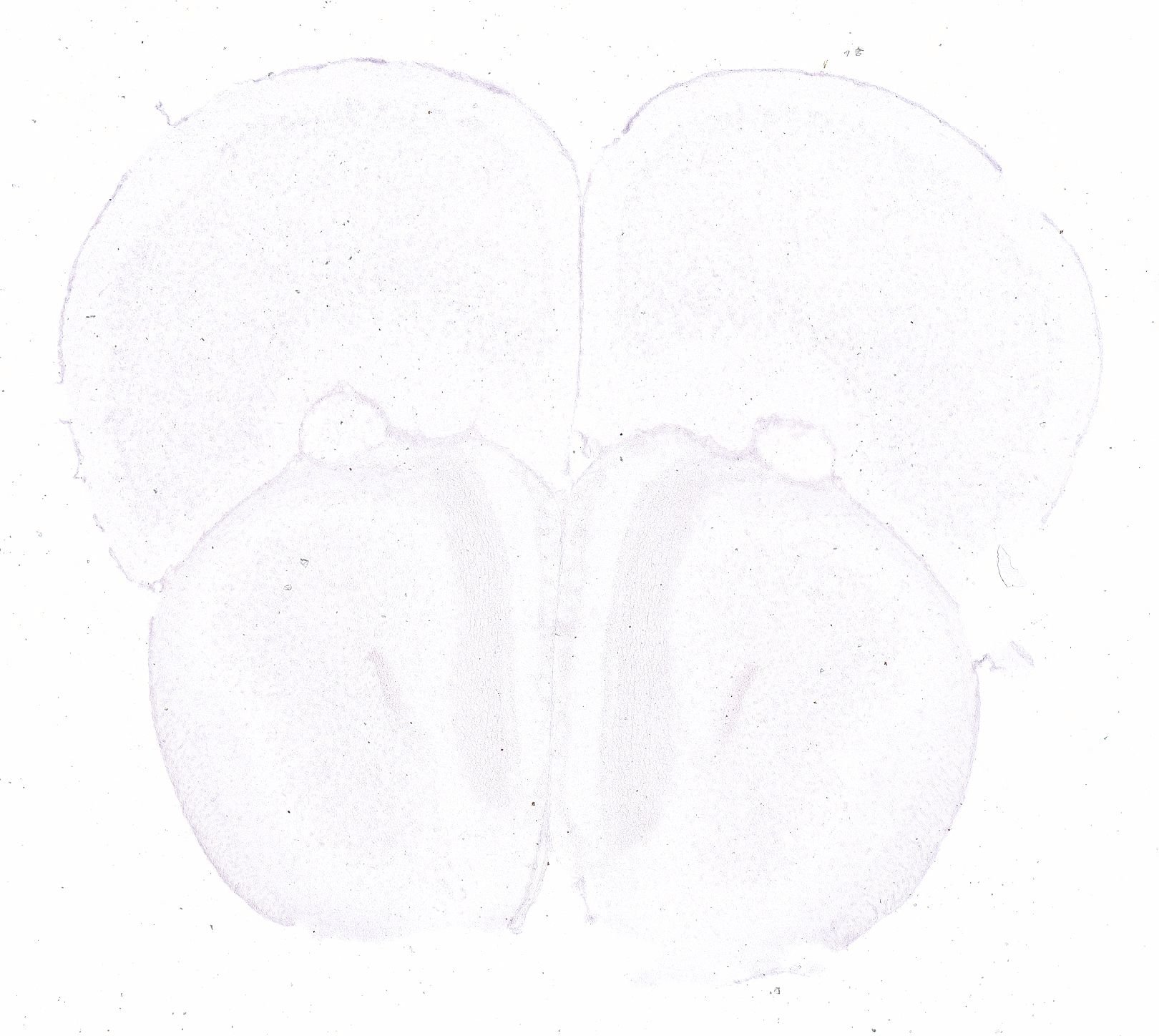 Allen ISH experiment 326, image 101337907 -- target region: LC (Locus ceruleus)