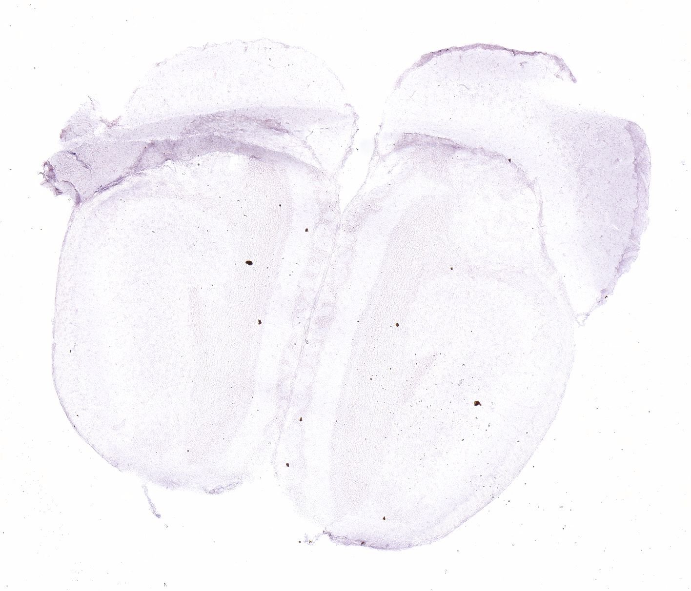 Allen ISH experiment 326, image 101337915 -- target region: LC (Locus ceruleus)