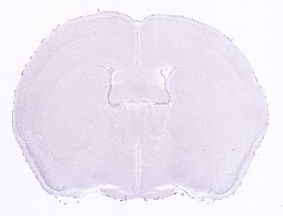 Allen ISH experiment 1484, image 101359431 -- target region: MPT (Medial pretectal area)