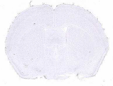 Allen ISH experiment 1484, image 101359439 -- target region: MPT (Medial pretectal area)
