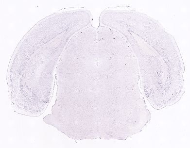 Allen ISH experiment 352, image 101322591 -- target region: OT (Olfactory tubercle)