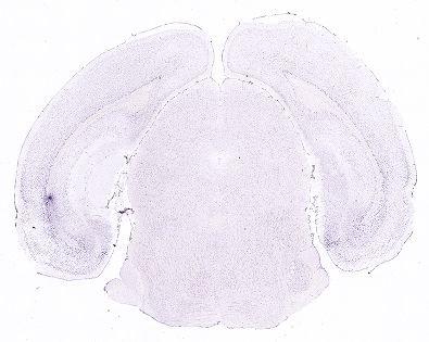 Allen ISH experiment 352, image 101322595 -- target region: OT (Olfactory tubercle)