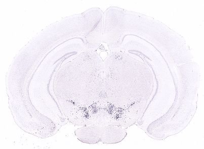 Allen ISH experiment 357, image 101322829 -- target region: CP (Caudoputamen)