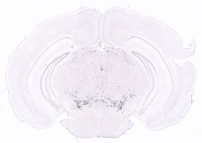 Allen ISH experiment 357, image 101322834 -- target region: CP (Caudoputamen)