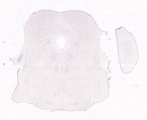 Allen ISH experiment 75038431, image 74929545 -- target region: OT (Olfactory tubercle)