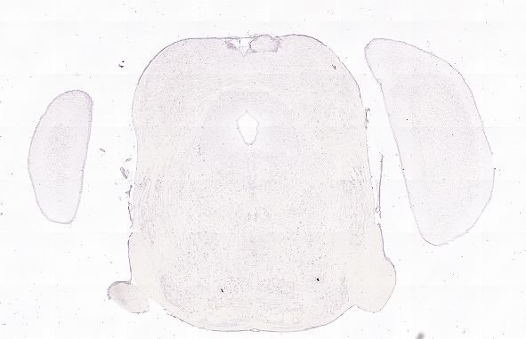 Allen ISH experiment 75038431, image 74929547 -- target region: OT (Olfactory tubercle)