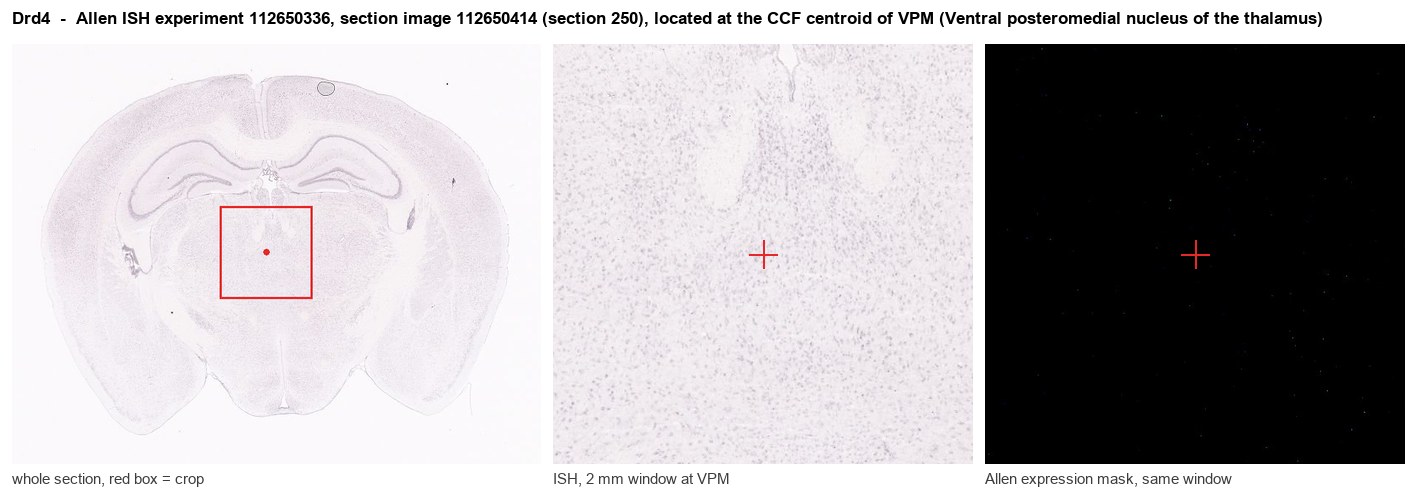 Drd4 Allen ISH at the CCF centroid of VPM