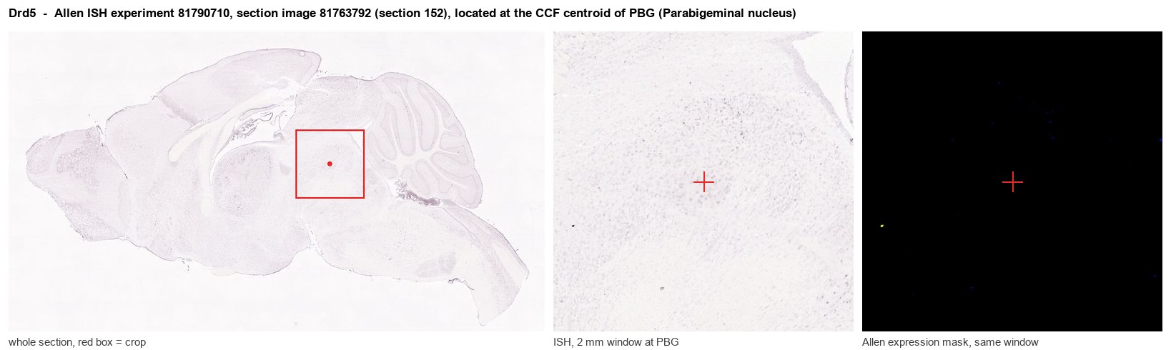 Drd5 Allen ISH at the CCF centroid of PBG