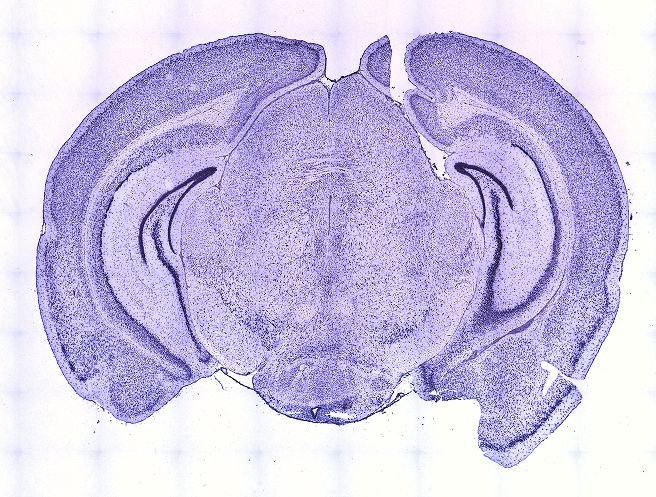 Allen ISH experiment 199391, image 100096522 -- target region: SCO (Subcommissural organ)