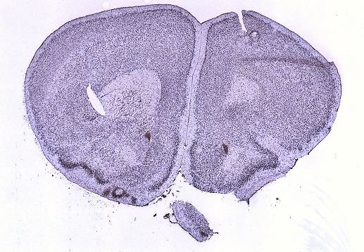 Allen ISH experiment 199391, image 100115430 -- target region: SCO (Subcommissural organ)