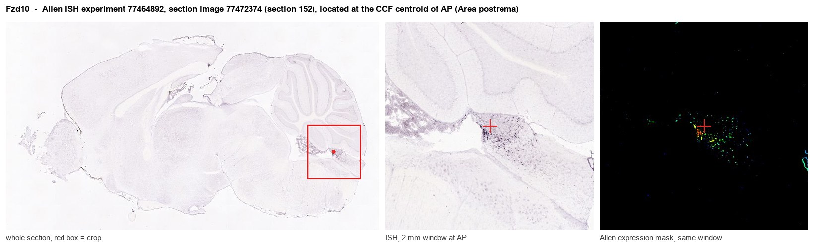 Fzd10 Allen ISH at the CCF centroid of AP