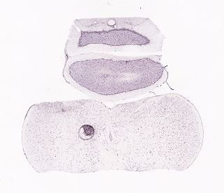 Allen ISH experiment 77925095, image 77929828 -- target region: AP (Area postrema)
