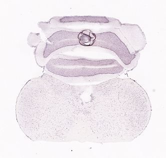 Allen ISH experiment 77925095, image 77929830 -- target region: AP (Area postrema)
