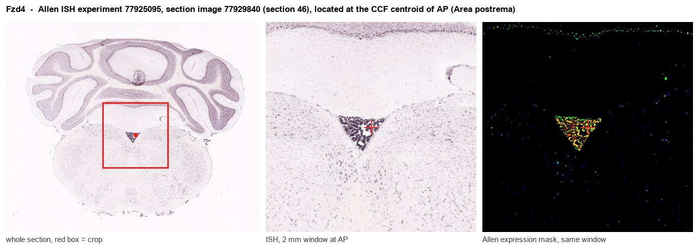 Fzd4 Allen ISH at the CCF centroid of AP