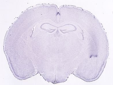 Allen ISH experiment 1500, image 101330141 -- target region: PF (Parafascicular nucleus)