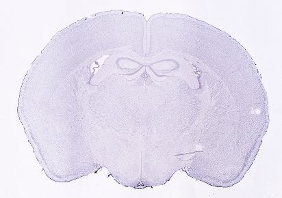 Allen ISH experiment 1500, image 101330147 -- target region: PF (Parafascicular nucleus)