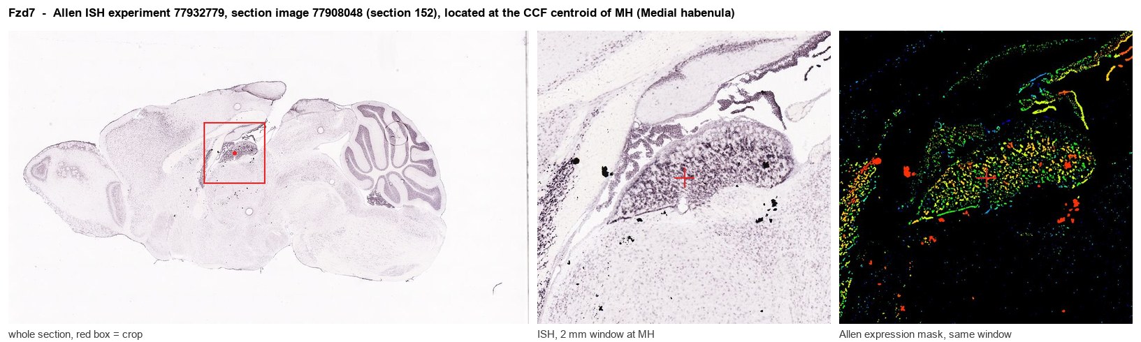Fzd7 Allen ISH at the CCF centroid of MH