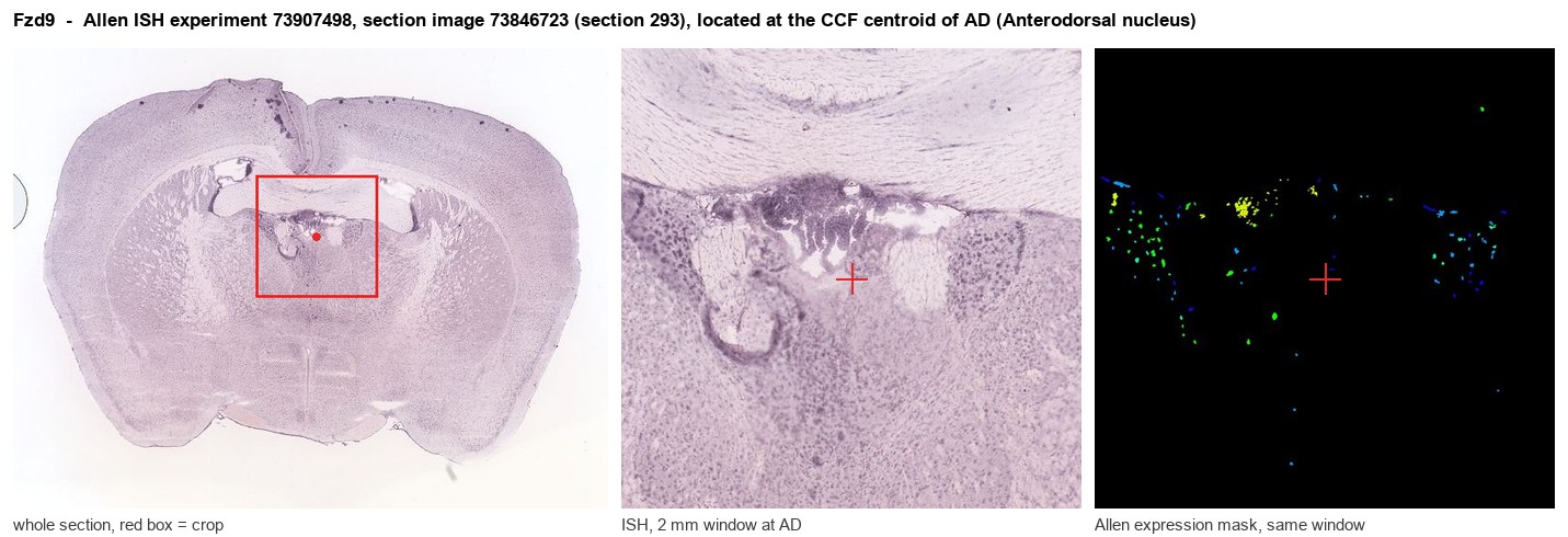 Fzd9 Allen ISH at the CCF centroid of AD