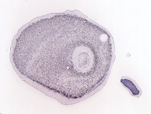Allen ISH experiment 68862120, image 68316676 -- target region: MH (Medial habenula)