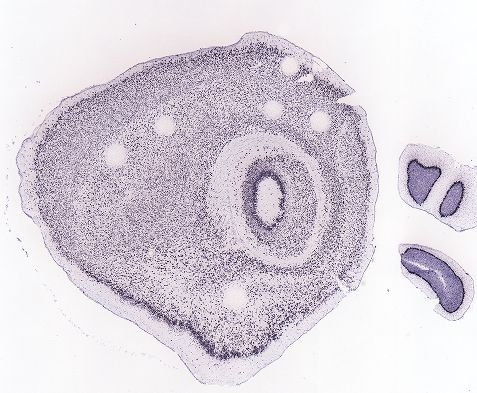 Allen ISH experiment 68862120, image 68316678 -- target region: MH (Medial habenula)
