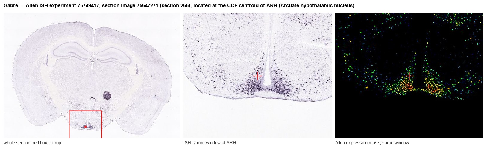 Gabre Allen ISH at the CCF centroid of ARH