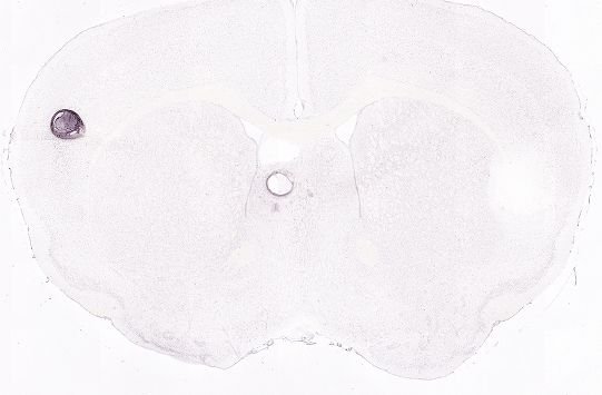 Allen ISH experiment 75551470, image 75487627 -- target region: SCsg (Superior colliculus, superficial gray layer)