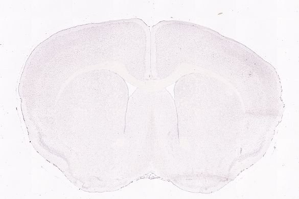 Allen ISH experiment 75551470, image 75487631 -- target region: SCsg (Superior colliculus, superficial gray layer)