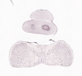 Allen ISH experiment 80517343, image 80481950 -- target region: SCO (Subcommissural organ)