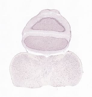 Allen ISH experiment 80517343, image 80481952 -- target region: SCO (Subcommissural organ)