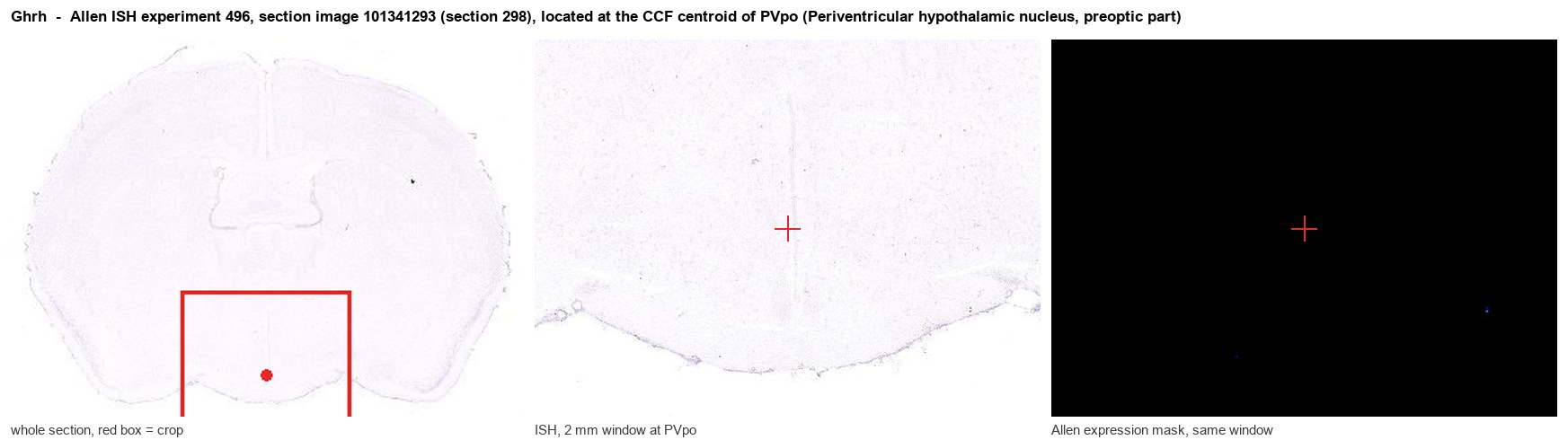 Ghrh Allen ISH at the CCF centroid of PVpo