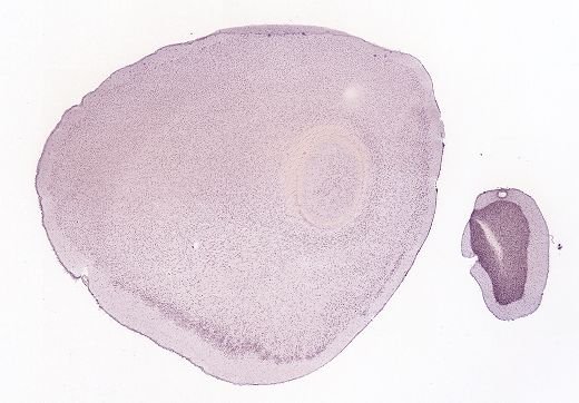 Allen ISH experiment 70305413, image 70169013 -- target region: SNc (Substantia nigra, compact part)