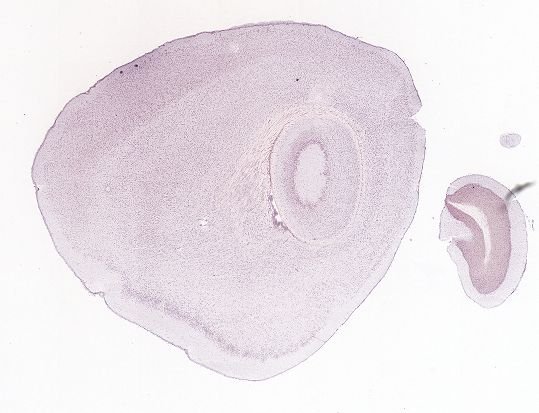 Allen ISH experiment 70305413, image 70169015 -- target region: SNc (Substantia nigra, compact part)
