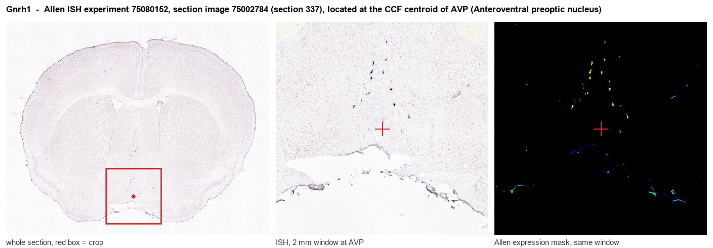 Gnrh1 Allen ISH at the CCF centroid of AVP