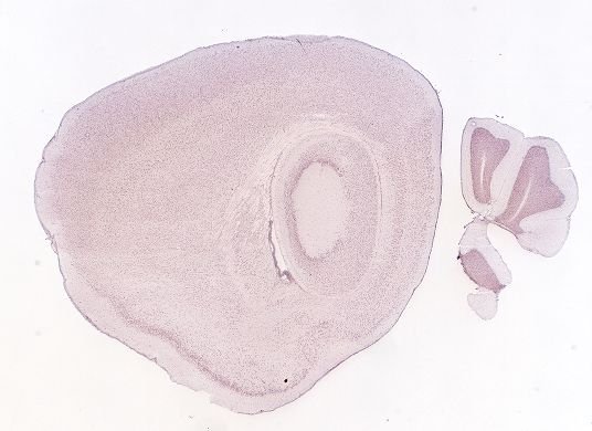Allen ISH experiment 70593007, image 70294804 -- target region: SH (Septohippocampal nucleus)