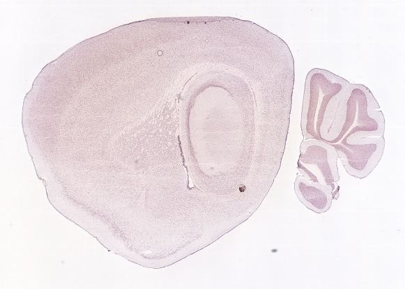 Allen ISH experiment 70593007, image 70294806 -- target region: SH (Septohippocampal nucleus)