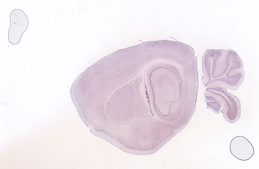 Allen ISH experiment 69257415, image 69238997 -- target region: IPR (Interpeduncular nucleus, rostral)