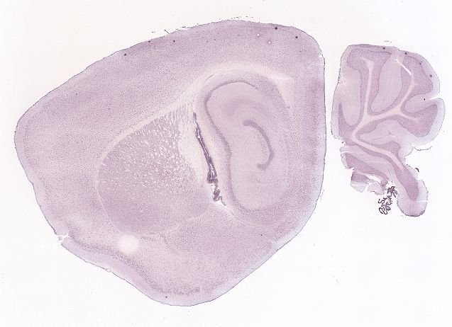 Allen ISH experiment 69257415, image 69238999 -- target region: IPR (Interpeduncular nucleus, rostral)