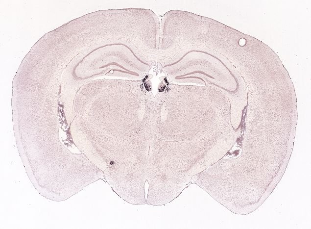 Allen ISH experiment 74724649, image 74648580 -- target region: MH (Medial habenula)