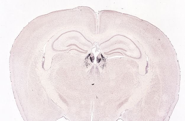 Allen ISH experiment 74724649, image 74648582 -- target region: MH (Medial habenula)