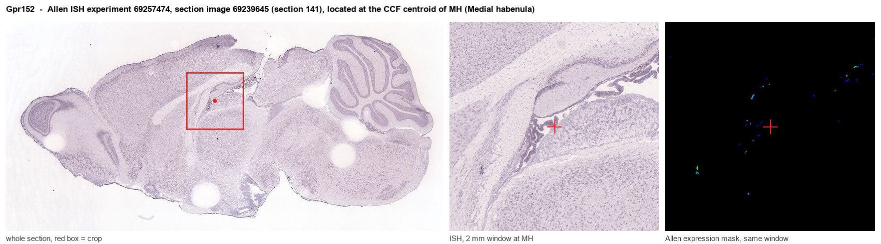 Gpr152 Allen ISH at the CCF centroid of MH