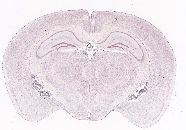 Allen ISH experiment 74641322, image 74532725 -- target region: MH (Medial habenula)