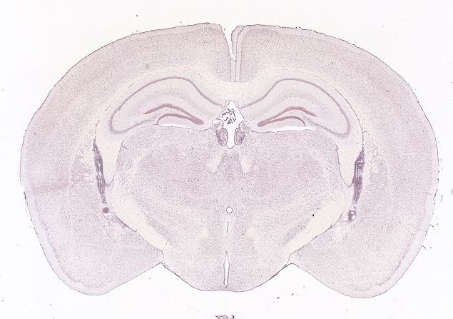 Allen ISH experiment 74641322, image 74532727 -- target region: MH (Medial habenula)