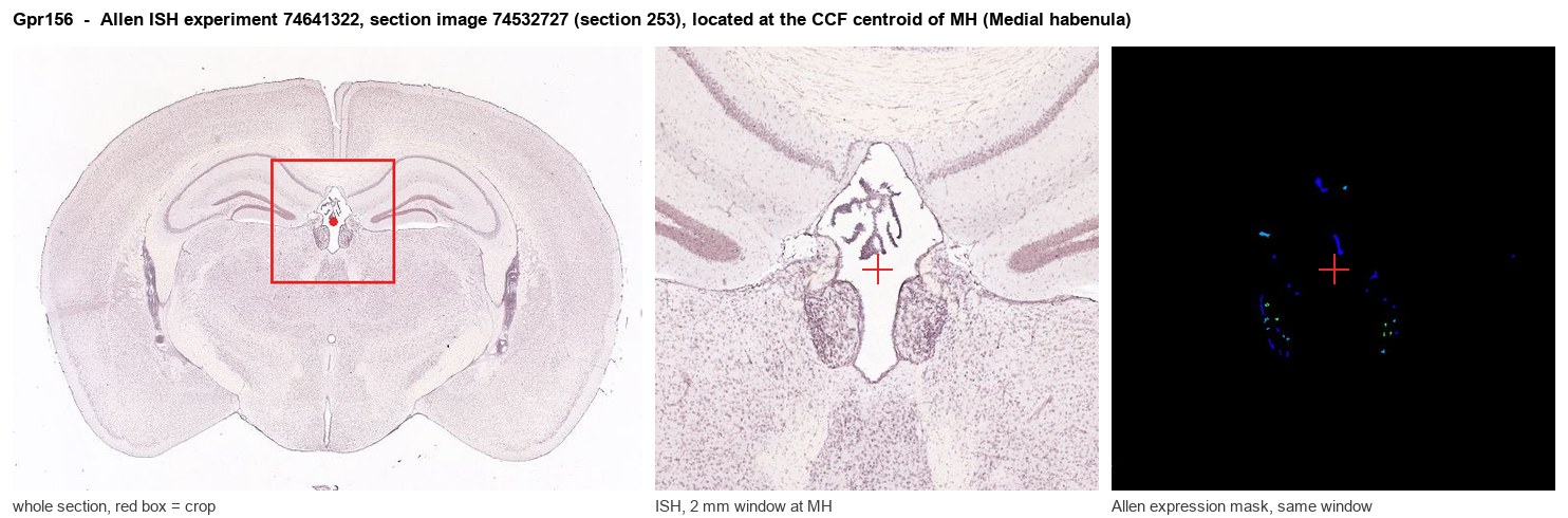 Gpr156 Allen ISH at the CCF centroid of MH