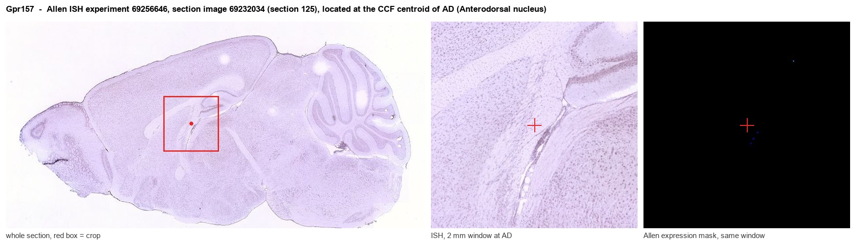 Gpr157 Allen ISH at the CCF centroid of AD