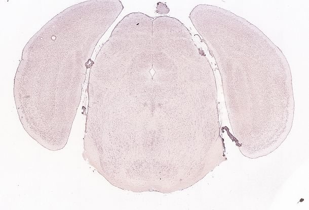 Allen ISH experiment 74511770, image 74395865 -- target region: OV (Vascular organ of the lamina terminalis)